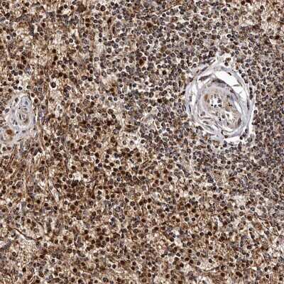 Immunohistochemistry-Paraffin: Bax Antibody [NBP1-88682]