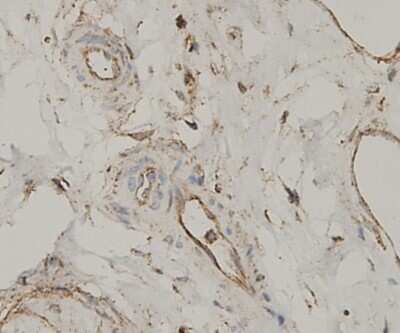 Immunohistochemistry-Paraffin: Bax Antibody [NBP2-67285]