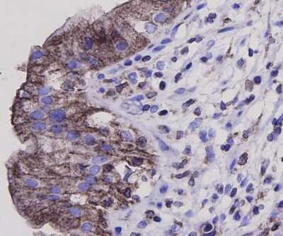 Immunohistochemistry-Paraffin: Bax Antibody [NBP2-67285]