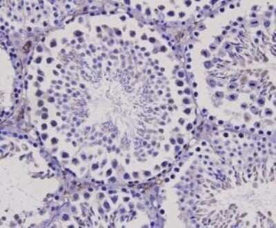 Immunohistochemistry-Paraffin: Bax Antibody [NBP2-67285]
