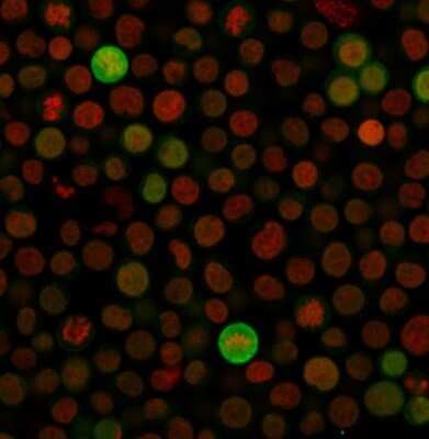 Immunocytochemistry/ Immunofluorescence: Bax Antibody (SPM336) - Azide and BSA Free [NBP2-34763]