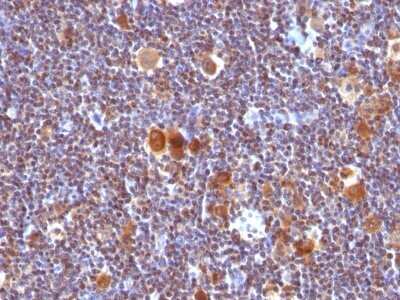 Immunohistochemistry-Paraffin: Bax Antibody (SPM336) - Azide and BSA Free [NBP2-34763]