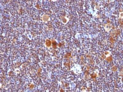 Immunohistochemistry-Paraffin: Bax Antibody (SPM336) - IHC-Prediluted [NBP2-44419]