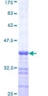 SDS-PAGE: Recombinant Human Bax GST (N-Term) Protein [H00000581-Q01]