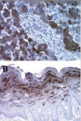 Immunohistochemistry-Paraffin: Bax inhibitor 1 Antibody (20F430) [NBP2-24919]