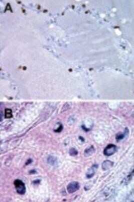 Immunohistochemistry-Paraffin: Bax inhibitor 1 Antibody (20F430) [NBP2-24919]