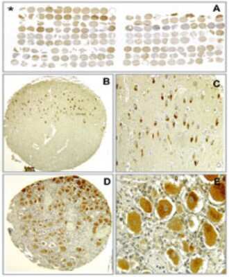 Immunohistochemistry-Paraffin: Bax inhibitor 1 Antibody (20F565) [NBP2-24912]