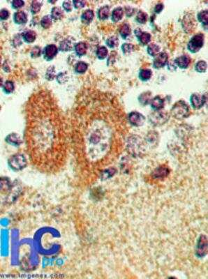 Immunohistochemistry-Paraffin: Bax inhibitor 1 Antibody (20F565) [NBP2-24912]