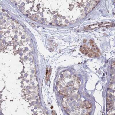 Immunohistochemistry-Paraffin: Bax inhibitor 1 Antibody [NBP2-48535]