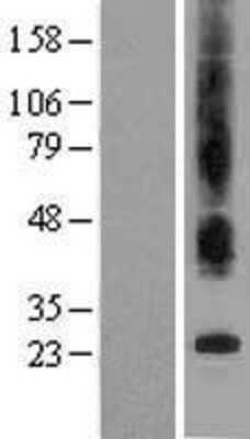 Western Blot: Bax inhibitor 1 Overexpression Lysate [NBL1-16807]