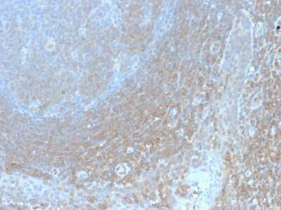 Immunohistochemistry-Paraffin: Bcl-10 Antibody (BL10/2988R) - Azide and BSA Free [NBP3-08803]