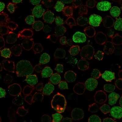 Immunocytochemistry/ Immunofluorescence: Bcl-10 Antibody (BL10/2988R) [NBP3-07482]