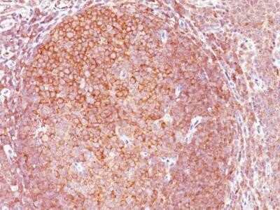 Immunohistochemistry-Paraffin: Bcl-10 Antibody (BL10/411) - Azide and BSA Free [NBP2-33190]