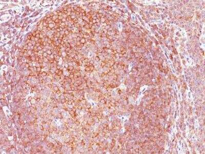 Immunohistochemistry-Paraffin: Bcl-10 Antibody (BL10/411) [NBP2-29422]