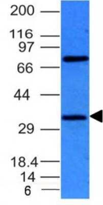 Western Blot: Bcl-10 Antibody (BL10/411) [NBP2-29422]