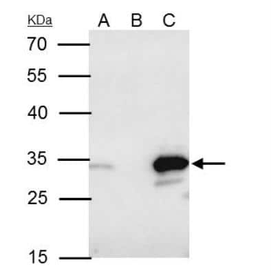 Immunoprecipitation: Bcl-10 Antibody [NBP2-15554]