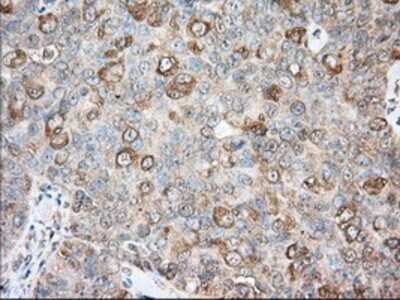 Immunohistochemistry: Bcl-10 Antibody (OTI4A8) - Azide and BSA Free [NBP2-71398]