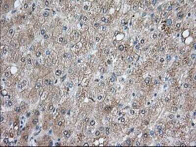 Immunohistochemistry: Bcl-10 Antibody (OTI4A8) - Azide and BSA Free [NBP2-71398]