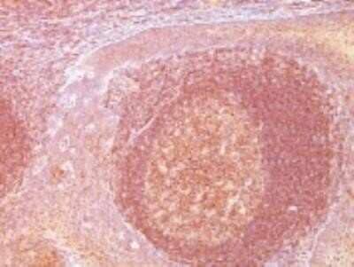 Immunohistochemistry-Paraffin: Bcl-10 Antibody (SPM520) - Azide and BSA Free [NBP2-34415]