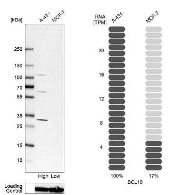 Western Blot: Bcl-10 Antibody [NBP1-85697]