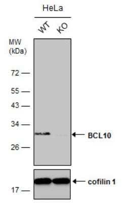 Knockout Validated: Bcl-10 Antibody [NBP2-15554]