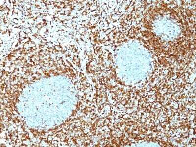 Immunohistochemistry-Paraffin: Bcl-2 Antibody (100/D5+124) - Azide and BSA Free [NBP2-34515]