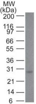 Western Blot: Bcl-2 Antibody (100/D5+124) [NBP2-34444]