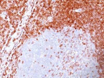 Immunohistochemistry-Paraffin: Bcl-2 Antibody (100/D5) - IHC-Prediluted [NBP2-44777]