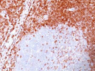 Immunohistochemistry-Paraffin: Bcl-2 Antibody (100/D5) [NBP2-15200]