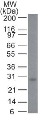 Western Blot: Bcl-2 Antibody (100/D5) [NBP2-15200]