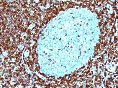 Immunohistochemistry-Paraffin: Bcl-2 Antibody (124) - Azide and BSA Free [NBP2-34513]