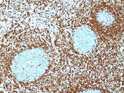 Immunohistochemistry-Paraffin: Bcl-2 Antibody (124) - Azide and BSA Free [NBP2-34513]