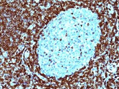 Immunohistochemistry-Paraffin: Bcl-2 Antibody (124) - IHC-Prediluted [NBP2-44780]