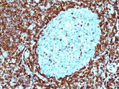 Immunohistochemistry-Paraffin: Bcl-2 Antibody (124) [NBP2-34443]