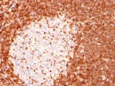 Immunohistochemistry-Paraffin: Bcl-2 Antibody (8C8) - Azide and BSA Free [NBP2-33313]