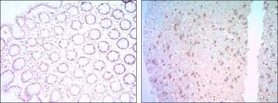 Immunohistochemistry-Paraffin: Bcl-2 Antibody (8E12) - BSA Free [NBP2-22170]
