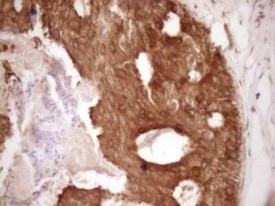 Immunohistochemistry: Bcl-2 Antibody (OTI9D3) [NBP2-46567]