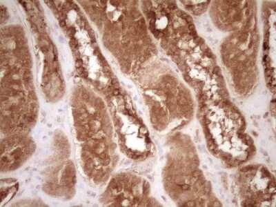 Immunohistochemistry: Bcl-2 Antibody (OTI9D3) [NBP2-46567]