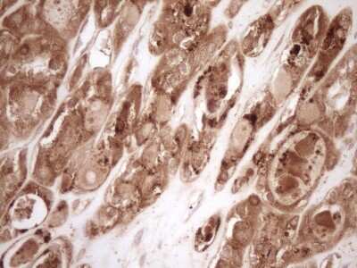 Immunohistochemistry: Bcl-2 Antibody (OTI9D3) [NBP2-46567]