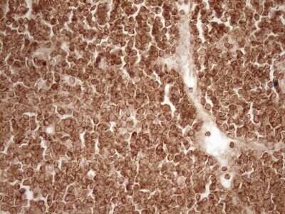 Immunohistochemistry: Bcl-2 Antibody (OTI9D3) [NBP2-46567]