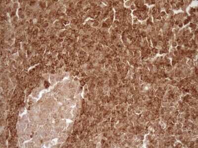 Immunohistochemistry: Bcl-2 Antibody (OTI9D3) [NBP2-46567]