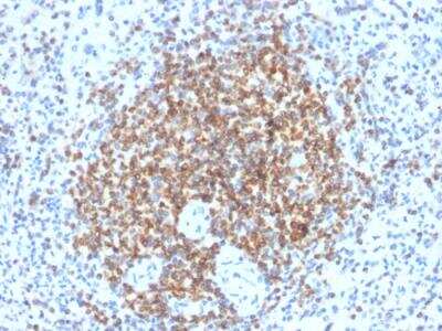 Immunohistochemistry-Paraffin: Bcl-2 Antibody (BCL2/2210R) - Azide and BSA Free [NBP2-75764]