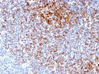 Immunohistochemistry-Paraffin: Bcl-2 Antibody (BCL2/2210R) - Azide and BSA Free [NBP2-75764]