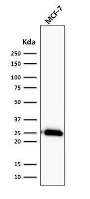 Western Blot: Bcl-2 Antibody (BCL2/2210R)Azide and BSA Free [NBP2-75764]