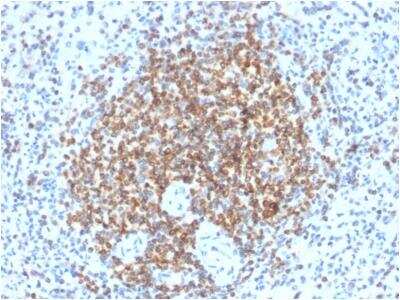 Immunohistochemistry-Paraffin: Bcl-2 Antibody (BCL2/2210R) [NBP2-75761]