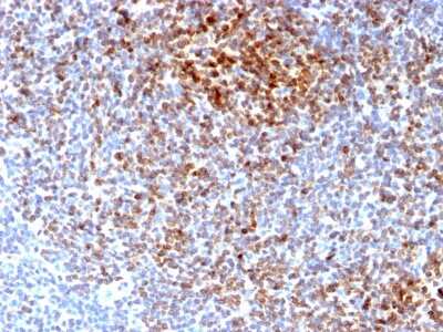 Immunohistochemistry-Paraffin: Bcl-2 Antibody (BCL2/2210R) [NBP2-75761]