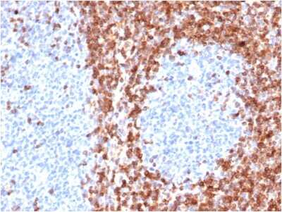 Immunohistochemistry-Paraffin: Bcl-2 Antibody (BCL2/6426R) - Azide and BSA Free [NBP3-08574]