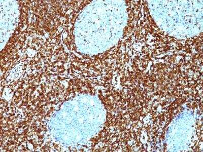 Immunohistochemistry-Paraffin: Bcl-2 Antibody (BCL2/782 + BCL2/796) - Azide and BSA Free [NBP2-47853]