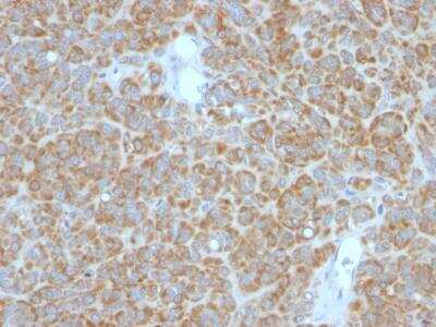Immunohistochemistry-Paraffin: Bcl-2 Antibody (BCL2/782 + BCL2/796) - Azide and BSA Free [NBP2-47853]