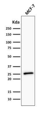 Western Blot: Bcl-2 Antibody (BCL2/782 + BCL2/796)Azide and BSA Free [NBP2-47853]